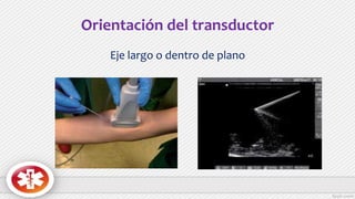 Orientación del transductor
Eje largo o dentro de plano
 