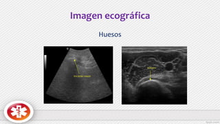 Imagen ecográfica
Huesos
 