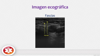 Imagen ecográfica
Fascias
 