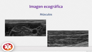 Imagen ecográfica
Músculos
 
