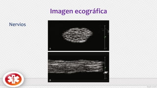 Imagen ecográfica
Nervios
 