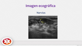 Imagen ecográfica
Nervios
 