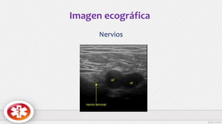 Imagen ecográfica
Nervios
 