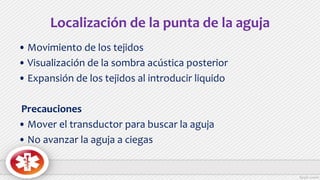 Localización de la punta de la aguja
• Movimiento de los tejidos
• Visualización de la sombra acústica posterior
• Expansión de los tejidos al introducir liquido
Precauciones
• Mover el transductor para buscar la aguja
• No avanzar la aguja a ciegas
 