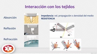 Absorción
Reflexión
Refracción
Interacción con los tejidos
Impedancia: vel. propagación x densidad del medio
RESISTENCIA
 