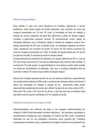 100
Efeito do Ângulo Mágico
Este artefato é visto com certa frequência em tendões, ligamentos e nervos
periféricos, onde certas partes do tecido aparecem com aumento de sinal nas
imagens ponderadas em T2 com TE curto. A orientação da fibra em relação a
direção do campo magnético principal (B0) determina o efeito do ângulo mágico.
Tendões e ligamentos possuem tempos T2 extremamente curtos, dadas as
interações dipolares que o hidrogênio, ligado a cadeias de colágeno, possui. Num
ângulo aproximado de 55º com a direção do B0, as interações dipolares se tornam
nulas, resultando num aumento do tempo T2 (cerca de 100 vezes) e aumento do
sinal em imagens ponderadas em T2[0]. O tendão de Aquiles altera seu T2 de 0,6
ms para 22 ms [46]. O aumento de sinal no tendão patelar.
O posicionamento da anatomia de interesse num ângulo diferente de 55º e o uso de
TE mais longos (acima de 37 ms) são as alternativas para eliminar este artefato. O
aumento do TE pode ajudar na especificidade de uma doença, porém pode resultar
em perda de sensibilidade na detecção, visto que a condição patológica terá de
aumentar o tempo T2 mais do que o efeito do ângulo mágico.
Deve-se ter cuidado especial quando do uso de exames dinâmicos, especialmente
em equipamentos abertos de RM, onde a anatomia de interesse realiza movimento e
altera sua orientação em relação a direção do B0. Atualmente estão sendo
desenvolvidas sequências de pulso que utilizam tempos de eco ultra-curtos (UTE –
Ultra short TE), onde o TE varia de 8 a 80 µs, o que faz com que se obtenha sinal
das fibras mesmo quando orientadas a 0º em relação ao B0 [0].
Artefato da Anestesia nas Imagens FLAIR
Hiperintensidades nas cisternas da base e nos espaços subaracnóideos em
imagens FLAIR (Fluid-Attenuated Inversion Recovery), de pacientes submetidos a
procedimentos anestésicos para realização do exame de RM, foram inicialmente
atribuídas ao uso de um anestésico conhecido como propofol [0]. Trabalhos
subsequentes mostraram que o suplemento de oxigênio resulta em encurtamento do
 