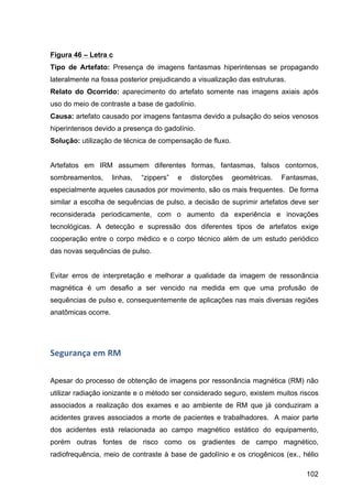 102
Figura 46 – Letra c
Tipo de Artefato: Presença de imagens fantasmas hiperintensas se propagando
lateralmente na fossa posterior prejudicando a visualização das estruturas.
Relato do Ocorrido: aparecimento do artefato somente nas imagens axiais após
uso do meio de contraste a base de gadolínio.
Causa: artefato causado por imagens fantasma devido a pulsação do seios venosos
hiperintensos devido a presença do gadolínio.
Solução: utilização de técnica de compensação de fluxo.
Artefatos em IRM assumem diferentes formas, fantasmas, falsos contornos,
sombreamentos, linhas, “zippers” e distorções geométricas. Fantasmas,
especialmente aqueles causados por movimento, são os mais frequentes. De forma
similar a escolha de sequências de pulso, a decisão de suprimir artefatos deve ser
reconsiderada periodicamente, com o aumento da experiência e inovações
tecnológicas. A detecção e supressão dos diferentes tipos de artefatos exige
cooperação entre o corpo médico e o corpo técnico além de um estudo periódico
das novas sequências de pulso.
Evitar erros de interpretação e melhorar a qualidade da imagem de ressonância
magnética é um desafio a ser vencido na medida em que uma profusão de
sequências de pulso e, consequentemente de aplicações nas mais diversas regiões
anatômicas ocorre.
Segurança	
  em	
  RM	
  
Apesar do processo de obtenção de imagens por ressonância magnética (RM) não
utilizar radiação ionizante e o método ser considerado seguro, existem muitos riscos
associados a realização dos exames e ao ambiente de RM que já conduziram a
acidentes graves associados a morte de pacientes e trabalhadores. A maior parte
dos acidentes está relacionada ao campo magnético estático do equipamento,
porém outras fontes de risco como os gradientes de campo magnético,
radiofrequência, meio de contraste à base de gadolínio e os criogênicos (ex., hélio
 