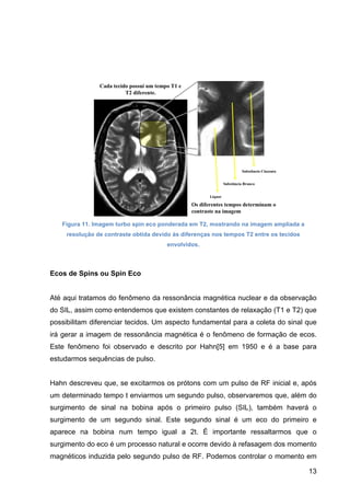 13
Figura 11. Imagem turbo spin eco ponderada em T2, mostrando na imagem ampliada a
resolução de contraste obtida devido às diferenças nos tempos T2 entre os tecidos
envolvidos.
Ecos de Spins ou Spin Eco
Até aqui tratamos do fenômeno da ressonância magnética nuclear e da observação
do SIL, assim como entendemos que existem constantes de relaxação (T1 e T2) que
possibilitam diferenciar tecidos. Um aspecto fundamental para a coleta do sinal que
irá gerar a imagem de ressonância magnética é o fenômeno de formação de ecos.
Este fenômeno foi observado e descrito por Hahn[5] em 1950 e é a base para
estudarmos sequências de pulso.
Hahn descreveu que, se excitarmos os prótons com um pulso de RF inicial e, após
um determinado tempo t enviarmos um segundo pulso, observaremos que, além do
surgimento de sinal na bobina após o primeiro pulso (SIL), também haverá o
surgimento de um segundo sinal. Este segundo sinal é um eco do primeiro e
aparece na bobina num tempo igual a 2t. É importante ressaltarmos que o
surgimento do eco é um processo natural e ocorre devido à refasagem dos momento
magnéticos induzida pelo segundo pulso de RF. Podemos controlar o momento em
 