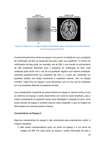 19
Figura 15. Espaço K e a imagem de RM correspondente após a aplicação da transformada de
fourier bidimensional (TF 2D).
O preenchimento linha-a-linha do espaço k irá ocorrer na medida em que o gradiente
de codificação de fase na sequência de pulso variar sua amplitude. O número de
codificações de fase pode, por exemplo, ser de 256, o que resulta no acionamento
de 256 amplitudes diferentes para o gradiente de codificação de fase. Esta
amplitude pode iniciar com o uso de um gradiente negativo com máxima amplitude,
reduzindo gradativamente sua amplitude até zero e, a partir daí, acionando um
gradiente positivo até atingir novamente a amplitude máxima, mas na direção
contrária. Cada linha do espaço k será preenchida com um eco que foi codificado
por uma amplitude diferente do gradiente de fase.
Uma característica importante do preenchimento do espaço k, descrito acima, é que
os extremos do espaço k serão preenchidos com sinal de baixa amplitude, pois o
próprio acionamento do gradiente causa maior defasagem e redução do sinal. Já as
linhas centrais do espaço k conterão sinal de maior amplitude, o que na imagem de
RM resultará em contraste (preto e branco).
Características do Espaço k
Algumas características do espaço k são importantes para entendermos melhor a
imagem resultante.
1) Não existe correspondência entre um ponto do espaço k e um ponto da
imagem de RM. Em cada ponto do espaço k existe informação de todo o
 