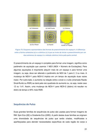 21
Figura 16. Esquema representativo das formas de preenchimento do espaço k. A diferença
entre a forma cartesiana (a) e a cêntrica (c) é que ao invés de iniciar o preenchimento por um
dos extremos do espaço k o método cêntrico inicia pela parte central.
O preenchimento de um espaço k completo para formar uma imagem, significa como
parâmetro de aquisição que usamos 1 NEX (NEX = Número de Excitações). Para
algumas aquisições é importante adquirir mais de um espaço k para formar uma
imagem, ou seja, deve ser alterado o parâmetro de NEX de 1 para 2, 3 ou mais. A
mudança de NEX=1 para NEX=2 implica em um tempo de aquisição duas vezes
maior. Por outro lado, o aumento na relação entre o sinal e o ruído (chamada Razão
Sinal-Ruído ou RSR) se dará pela raiz quadrada do aumento ou, os seja, neste caso
√2 ou 1,41. Assim, uma mudança de NEX=1 para NEX=2 (dobro) irá resultar no
dobro de tempo e 40% mais RSR.
Sequências	
  de	
  Pulso	
  
Duas grandes famílias de sequências de pulso são usadas para formar imagens de
RM: Spin Eco (SE) e Gradiente Eco (GRE). A partir destas duas famílias se originam
uma diversidade de sequências de pulso que serão criadas, modificadas e
aperfeiçoadas para atender necessidades específicas de cada região do corpo e
 