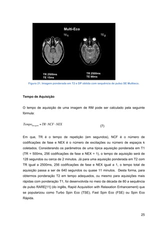 25
Figura 21. Imagem ponderada em T2 e DP obtida com sequência de pulso SE Multieco.
Tempo de Aquisição
O tempo de aquisição de uma imagem de RM pode ser calculado pela seguinte
fórmula:
€
TempoIm agem = TR⋅ NCF ⋅ NEX (7)
Em que, TR é o tempo de repetição (em segundos), NCF é o número de
codificações de fase e NEX é o número de excitações ou número de espaços k
coletados. Considerando os parâmetros de uma típica aquisição ponderada em T1
(TR = 500ms, 256 codificações de fase e NEX = 1), o tempo de aquisição será de
128 segundos ou cerca de 2 minutos. Já para uma aquisição ponderada em T2 com
TR igual a 2500ms, 256 codificações de fase e NEX igual a 1, o tempo total de
aquisição passa a ser de 640 segundos ou quase 11 minutos. Desta forma, para
obtermos ponderação T2 em tempo adequados, ou mesmo para aquisições mais
rápidas com ponderação T1, foi desenvolvida no meio da década de 80 a sequência
de pulso RARE[11] (do inglês, Rapid Acquisition with Relaxation Enhancement) que
se popularizou como Turbo Spin Eco (TSE), Fast Spin Eco (FSE) ou Spin Eco
Rápida.
 