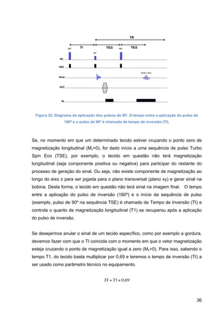 36
Figura 32. Diagrama da aplicação dos pulsos de RF. O tempo entre a aplicação do pulso de
180º e o pulso de 90º é chamado de tempo de inversão (TI).
Se, no momento em que um determinado tecido estiver cruzando o ponto zero de
magnetização longitudinal (Mz=0), for dado início a uma sequência de pulso Turbo
Spin Eco (TSE), por exemplo, o tecido em questão não terá magnetização
longitudinal (seja componente positiva ou negativa) para participar do restante do
processo de geração do sinal. Ou seja, não existe componente de magnetização ao
longo do eixo z para ser jogada para o plano transversal (plano xy) e gerar sinal na
bobina. Desta forma, o tecido em questão não terá sinal na imagem final. O tempo
entre a aplicação do pulso de inversão (180º) e o início da sequência de pulso
(exemplo, pulso de 90º na sequência TSE) é chamado de Tempo de Inversão (TI) e
controla o quanto de magnetização longitudinal (T1) se recuperou após a aplicação
do pulso de inversão.
Se desejarmos anular o sinal de um tecido específico, como por exemplo a gordura,
devemos fazer com que o TI coincida com o momento em que o vetor magnetização
esteja cruzando o ponto de magnetização igual a zero (Mz=0). Para isso, sabendo o
tempo T1, do tecido basta multiplicar por 0,69 e teremos o tempo de inversão (TI) a
ser usado como parâmetro técnico no equipamento.
€
TI = T1× 0,69
 