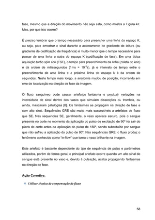 58
fase, mesmo que a direção do movimento não seja esta, como mostra a Figura 47.
Mas, por que isto ocorre?
É preciso lembrar que o tempo necessário para preencher uma linha do espaço K,
ou seja, para amostrar o sinal durante o acionamento do gradiente de leitura (ou
gradiente de codificação de frequência) é muito menor que o tempo necessário para
passar de uma linha a outra do espaço K (codificação de fase). Em uma típica
aquisição turbo spin eco (TSE), o tempo para preenchimento da linha (coleta do eco)
é da ordem de milissegundos (1ms = 10-3
s), já o intervalo de tempo entre o
preenchimento de uma linha e a próxima linha do espaço k é da ordem de
segundos. Neste tempo mais longo, a anatomia mudou de posição, incorrendo em
erro de localização na direção de fase da imagem.
O fluxo sanguíneo pode causar artefatos fantasma e produzir variações na
intensidade de sinal dentro dos vasos que simulam dissecções ou trombos, ou
ainda, mascaram patologias [0]. Os fantasmas se propagam na direção de fase e
com alto sinal. Sequências GRE são muito mais susceptíveis a artefatos de fluxo
que SE. Nas sequencias SE, geralmente, o vaso aparece escuro, pois o sangue
presente no corte no momento da aplicação do pulso de excitação de 90º irá sair do
plano de corte antes da aplicação do pulso de 180º, sendo substituído por sangue
que não sofreu a aplicação do pulso de 90º. Nas sequências GRE, o fluxo produz o
fenômeno conhecido como “in-flow” que torna o vaso brilhante na imagem.
Este artefato é bastante dependente do tipo de sequência de pulso e parâmetros
utilizados, porém de forma geral, o principal artefato ocorre quando um alto sinal do
sangue está presente no vaso e, devido à pulsação, acaba propagando fantasmas
na direção de fase.
Ação Corretiva:
v Utilizar técnica de compensação de fluxo	
  
 