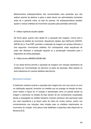 64
Medicamentos antiespasmódicos são recomendados para pacientes que irão
realizar exames de abdome e pelve e estes devem ser administrados momentos
antes de o paciente entrar na sala de exames. Os antiespasmódicos também
ajudam a reduzir artefatos de movimento causados pela peristalse uterina [0].
v Utilizar sequências de pulso rápidas
De forma geral, quanto mais rápida for a aquisição das imagens, menor será a
presença de artefato de movimento. Sequências rápidas, tipo half-fourier (HASTE,
SSFSE etc) e True-FISP, permitem a obtenção de imagens em tempos inferiores a
dois segundos, minimizando artefatos. Em contrapartida, estas sequências de
pulso não oferecem a resolução espacial ou a ponderação necessária para o
diagnóstico de certas patologias.
v Utilizar técnica PROPELLER/BLADE
O uso desta técnica permite a aquisição de imagens com redução significativa de
artefatos por movimentação da estrutura no plano de aquisição. Mais adiante no
texto trataremos em maiores detalhes esta técnica.
Movimento Cardíaco
O batimento cardíaco durante a aquisição das imagens faz com que ocorra um erro
na codificação espacial, formando um artefato que se propaga na direção de fase,
como mostra a Figura 53. O coração é apresentado como um grande borrão na
imagem e estruturas na direção de fase deixam de ser corretamente visualizadas
devido a propagação do artefato fantasma. Exames cardíacos vêm ganhando cada
vez mais importância e já fazem parte da rotina de muitos centros, porém nos
concentraremos nas soluções mais simples para os artefatos relacionados ao
movimento do coração. Uma leitura mais detalhada e específica está disponível na
literatura [0,0].
 