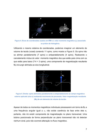 7
Figura 4. Eixos de coordenadas usados em IRM e o vetor momento magnético (µ) associado
ao próton de hidrogênio.
Utilizando o mesmo sistema de coordenadas, podemos imaginar um elemento de
volume de tecido (voxel) contendo 11 spins, como mostra a Figura 5. Os spins irão
se alinhar paralelamente (7 spins) e antiparalelamente (4 spins). Realizando o
cancelamento mútuo do vetor momento magnético dos que estão para cima com os
que estão para baixo (7-4 = 3 spins), uma componente de magnetização resultante
M0 irá surgir alinhada ao eixo longitudinal.
Figura 5. Direita: spins alinhados paralelamente e antiparalelamente ao campo magnético
externo aplicado (eixo z) realizando movimento de precessão. Vetor magnetização resultante
(M0) de um elemento de volume do tecido.
Apesar de todos os momentos magnéticos individuais precessarem em torno de B0 a
uma frequência angular igual a ω, não existe coerência de fase entre eles e,
portanto, não irá existir componente de magnetização no plano transversal. Uma
bobina posicionada de forma perpendicular ao plano transversal não irá detectar
nenhum sinal, pois não ocorrerá alteração no fluxo magnético.
 