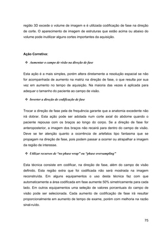 75
região 3D excede o volume de imagem e é utilizada codificação de fase na direção
de corte. O aparecimento de imagem de estruturas que estão acima ou abaixo do
volume pode inutilizar alguns cortes importantes da aquisição.
Ação Corretiva:
v Aumentar o campo de visão na direção de fase
Esta ação é a mais simples, porém altera diretamente a resolução espacial se não
for acompanhada de aumento na matriz na direção de fase, o que resulta por sua
vez em aumento no tempo de aquisição. Na maioria das vezes é aplicada para
adequar o tamanho do paciente ao campo de visão.
v Inverter a direção de codificação de fase
Trocar a direção de fase pela de frequência garante que a anatomia excedente não
irá dobrar. Esta ação pode ser adotada num corte axial do abdome quando o
paciente repousa com os braços ao longo do corpo. Se a direção de fase for
anteroposterior, a imagem dos braços não recairá para dentro do campo de visão.
Deve se ter atenção quanto a ocorrência de artefatos tipo fantasma que se
propagam na direção de fase, pois podem passar a ocorrer ou atrapalhar a imagem
da região de interesse.
v Utilizar recursos de “no phase wrap” ou “phase oversampling”
Esta técnica consiste em codificar, na direção de fase, além do campo de visão
definido. Esta região extra que foi codificada não será mostrada na imagem
reconstruída. Em alguns equipamentos o uso desta técnica faz com que
automaticamente a área codificada em fase aumente 50% simetricamente para cada
lado. Em outros equipamentos uma seleção de valores porcentuais do campo de
visão pode ser selecionada. Cada aumento de codificação de fase irá resultar
proporcionalmente em aumento de tempo de exame, porém com melhoria na razão
sinal-ruído.
 
