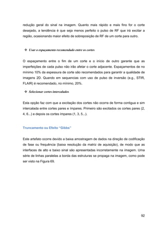 92
redução geral do sinal na imagem. Quanto mais rápido e mais fino for o corte
desejado, a tendência é que seja menos perfeito o pulso de RF que irá excitar a
região, ocasionando maior efeito de sobreposição de RF de um corte para outro.
v Usar o espaçamento recomendado entre os cortes
O espaçamento entre o fim de um corte e o início de outro garante que as
imperfeições de cada pulso não irão afetar o corte adjacente. Espaçamentos de no
mínimo 10% da espessura de corte são recomendados para garantir a qualidade de
imagens 2D. Quando em sequencias com uso de pulso de inversão (e.g., STIR,
FLAIR) é recomendado, no mínimo, 20%.
v Selecionar cortes intercalados
Esta opção faz com que a excitação dos cortes não ocorra de forma contigua e sim
intercalada entre cortes pares e ímpares. Primeiro são excitados os cortes pares (2,
4, 6...) e depois os cortes ímpares (1, 3, 5...).
Truncamento ou Efeito “Gibbs”
Este artefato ocorre devido a baixa amostragem de dados na direção de codificação
de fase ou frequência (baixa resolução da matriz de aquisição), de modo que as
interfaces de alto e baixo sinal são apresentadas incorretamente na imagem. Uma
série de linhas paralelas a borda das estruturas se propaga na imagem, como pode
ser visto na Figura 69.
 