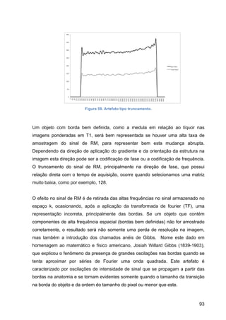 93
Figura 59. Artefato tipo truncamento.
Um objeto com borda bem definida, como a medula em relação ao líquor nas
imagens ponderadas em T1, será bem representada se houver uma alta taxa de
amostragem do sinal de RM, para representar bem esta mudança abrupta.
Dependendo da direção de aplicação do gradiente e da orientação da estrutura na
imagem esta direção pode ser a codificação de fase ou a codificação de frequência.
O truncamento do sinal de RM, principalmente na direção de fase, que possui
relação direta com o tempo de aquisição, ocorre quando selecionamos uma matriz
muito baixa, como por exemplo, 128.
O efeito no sinal de RM é de retirada das altas frequências no sinal armazenado no
espaço k, ocasionando, após a aplicação da transformada de fourier (TF), uma
representação incorreta, principalmente das bordas. Se um objeto que contém
componentes de alta frequência espacial (bordas bem definidas) não for amostrado
corretamente, o resultado será não somente uma perda de resolução na imagem,
mas também a introdução dos chamados anéis de Gibbs. Nome este dado em
homenagem ao matemático e físico americano, Josiah Willard Gibbs (1839-1903),
que explicou o fenômeno da presença de grandes oscilações nas bordas quando se
tenta aproximar por séries de Fourier uma onda quadrada. Este artefato é
caracterizado por oscilações de intensidade de sinal que se propagam a partir das
bordas na anatomia e se tornam evidentes somente quando o tamanho da transição
na borda do objeto e da ordem do tamanho do pixel ou menor que este.
 