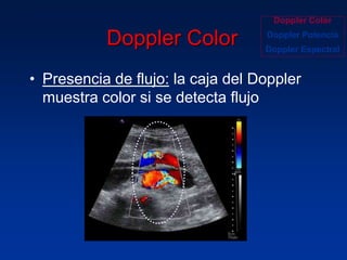Principios fisicos de ecografia doppler | PPTX