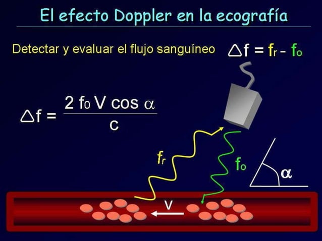 Principios Fisicos De Ecografia Doppler