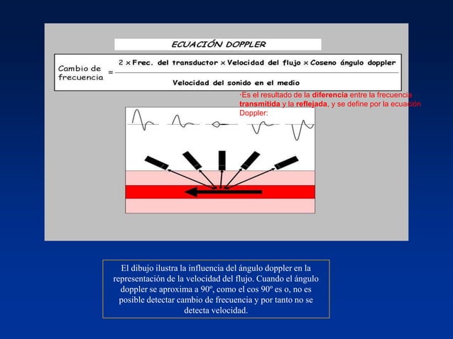 Principios Fisicos De Ecografia Doppler