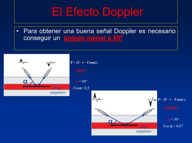 Principios Fisicos De Ecografia Doppler