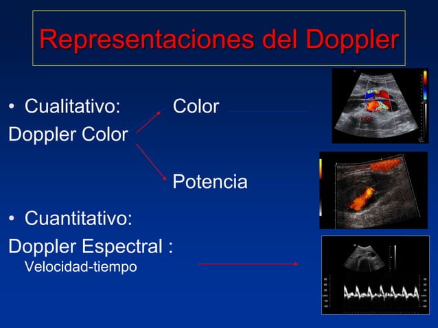 Principios Fisicos De Ecografia Doppler