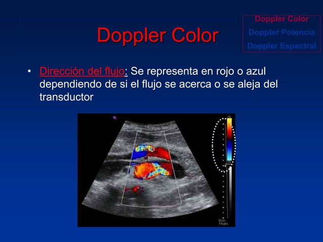 Principios Fisicos De Ecografia Doppler
