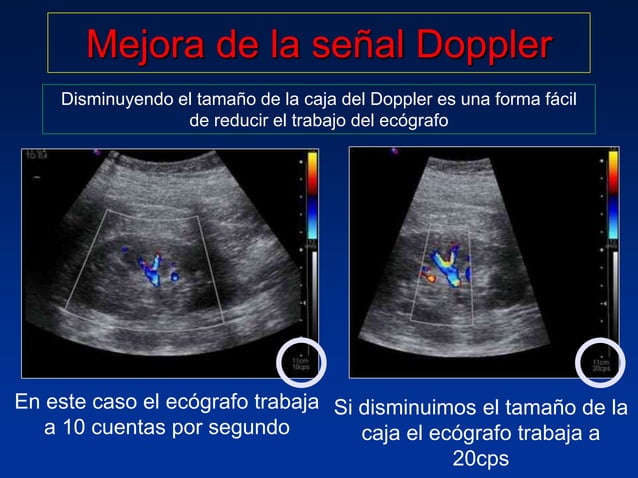 Principios Fisicos De Ecografia Doppler