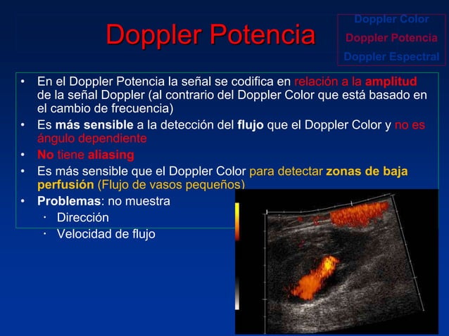 Principios Fisicos De Ecografia Doppler