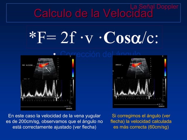 Principios Fisicos De Ecografia Doppler
