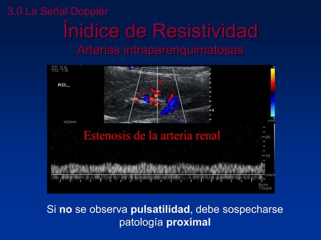 Principios Fisicos De Ecografia Doppler