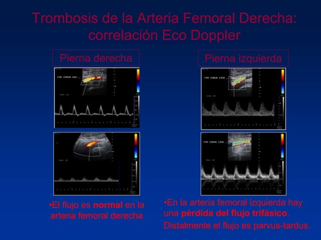 Principios Fisicos De Ecografia Doppler