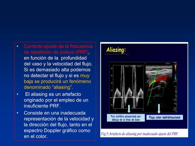 Principios Fisicos De Ecografia Doppler