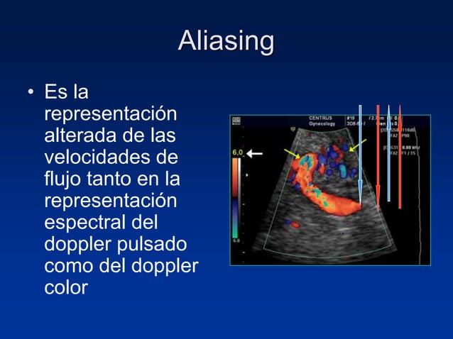 Principios Fisicos De Ecografia Doppler