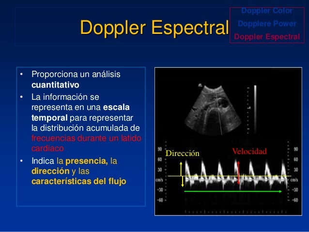 Principios Fisicos De Ecografia Doppler