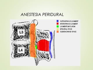 ANESTESIA PERIDURAL
ANESTESIA REGIONAL
 
