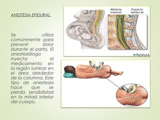 ANESTESIA EPIDURAL
Se utiliza
comúnmente para
prevenir dolor
durante el parto. El
anestesiólogo
inyecta el
medicamento en
la región lumbar en
el área alrededor
de la columna. Este
tipo de anestesia
hace que se
pierda sensibilidad
en la mitad inferior
del cuerpo.
 