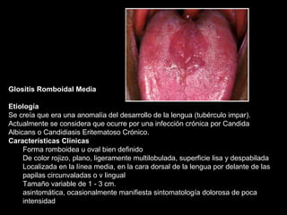 Glositis Romboidal Media
Etiología
Se creía que era una anomalía del desarrollo de la lengua (tubérculo impar).
Actualmente se considera que ocurre por una infección crónica por Candida
Albicans o Candidiasis Eritematoso Crónico.
Características Clínicas
Forma romboidea u oval bien definido
De color rojizo, plano, ligeramente multilobulada, superficie lisa y despabilada
Localizada en la línea media, en la cara dorsal de la lengua por delante de las
papilas circunvaladas o v lingual
Tamaño variable de 1 - 3 cm.
asintomática, ocasionalmente manifiesta sintomatología dolorosa de poca
intensidad
 