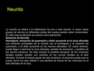 La neuritis se refiere a la inflamación de uno o más nervios. A veces varios
grupos de nervios en diferentes partes del cuerpo pueden estar involucrados.
En este caso la afección se conoce como polineuritis.
Síntomas de Neuritis
Hormigueo, sensación de quemazón y dolor punzante en la zona afectada
Los síntomas principales de la neuritis son el hormigueo y la cesación de
quemazón, y el dolor punzante en los nervios afectados. En casos severos,
puede llegar a dormirse la zona afectada, perdida de sensación, y parálisis de
los nervios cercanos. De esta manera la parálisis temporal, de los músculos
faciales pueden resultar con cambios en los nervios faciales en el lado
afectado. Durante el estado agudo de esta condición, el paciente puede que no
pueda cerrar los ojos debido a una perdida de fuerza de los músculos en el
lado afectado de la cara.
Neuritis
 