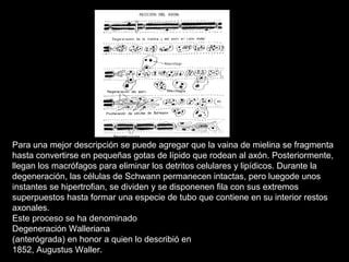 Para una mejor descripción se puede agregar que la vaina de mielina se fragmenta
hasta convertirse en pequeñas gotas de lípido que rodean al axón. Posteriormente,
llegan los macrófagos para eliminar los detritos celulares y lipídicos. Durante la
degeneración, las células de Schwann permanecen intactas, pero luegode unos
instantes se hipertrofian, se dividen y se disponenen fila con sus extremos
superpuestos hasta formar una especie de tubo que contiene en su interior restos
axonales.
Este proceso se ha denominado
Degeneración Walleriana
(anterógrada) en honor a quien lo describió en
1852, Augustus Waller.
 