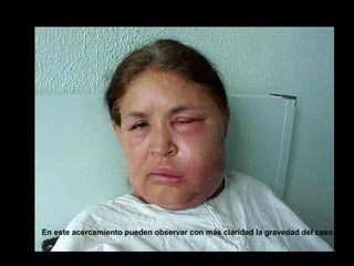 En este acercamiento pueden observar con más claridad la gravedad del caso.
 