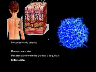 Mecanismos de defensa
Barreras naturales
Resistencia o inmunidad (natural o adquirida)
Inflamación
 