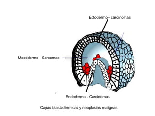 Ectodermo - carcinomas
Endodermo - Carcinomas
Mesodermo - Sarcomas
Capas blastodérmicas y neoplasias malignas
 