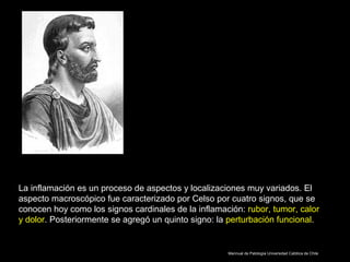 La inflamación es un proceso de aspectos y localizaciones muy variados. El
aspecto macroscópico fue caracterizado por Celso por cuatro signos, que se
conocen hoy como los signos cardinales de la inflamación: rubor, tumor, calor
y dolor. Posteriormente se agregó un quinto signo: la perturbación funcional.
Mannual de Patología Universidad Católica de Chile
 