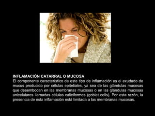 INFLAMACIÓN CATARRAL O MUCOSA
El componente característico de este tipo de inflamación es el exudado de
mucus producido por células epiteliales, ya sea de las glándulas mucosas
que desembocan en las membranas mucosas o en las glándulas mucosas
unicelulares llamadas células caliciformes (goblet cells). Por esta razón, la
presencia de esta inflamación está limitada a las membranas mucosas.
 