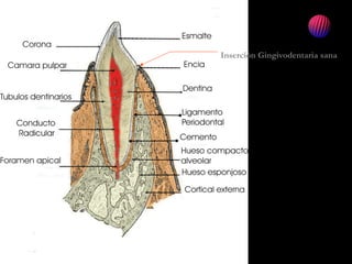 Encia sana
Inserción Gingivodentaria sana
 