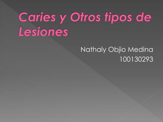 Nathaly Objio Medina 
100130293 
 