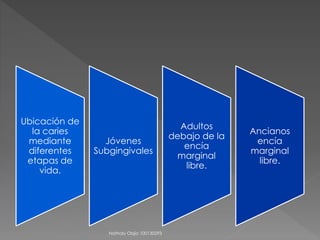 Ubicación de 
la caries 
mediante 
diferentes 
etapas de 
vida. 
Jóvenes 
Subgingivales 
Adultos 
debajo de la 
encía 
marginal 
libre. 
Ancianos 
encía 
marginal 
libre. 
Nathaly Objio 100130293 
 