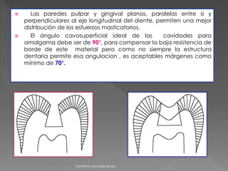  Las paredes pulpar y gingival planas, paralelas entre si y 
perpendiculares al eje longitudinal del diente, permiten una mejor 
distribución de los esfuerzos masticatorios. 
 El ángulo cavosuperficial ideal de las cavidades para 
amalgama debe ser de 90°, para compensar la baja resistencia de 
borde de este material pero como no siempre la estructura 
dentaria permite esa angulacion , es aceptables márgenes como 
mínimo de 70°. 
Katherine González Reyes 
 